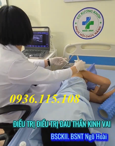 Các lưu ý khi mua máy siêu âm cơ xương khớp bạn cần phải biết